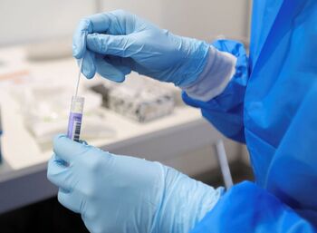 Países Bajos detectó la variante ómicron antes que Sudáfrica