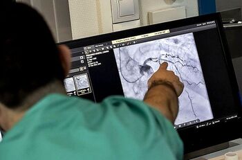 El 95% de los pacientes que superan un infarto recibe un stent