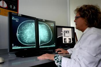El Sescam anuncia una nueva técnica contra el cáncer de mama